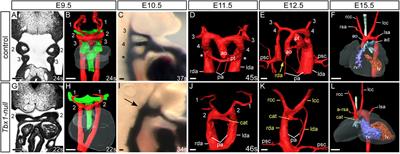 Morphogenesis of the Mammalian Aortic Arch Arteries